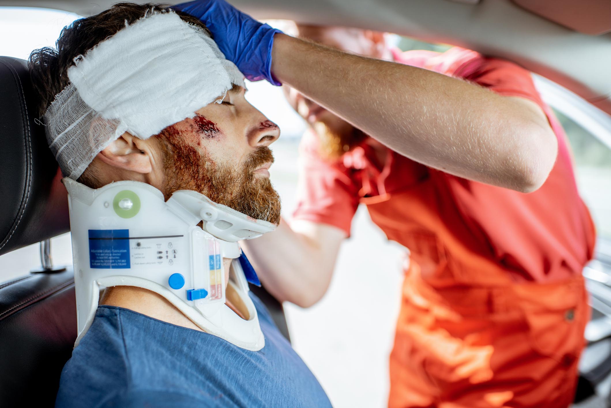 Traumatic Brain Injury